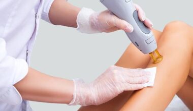 Laser-hair-removal